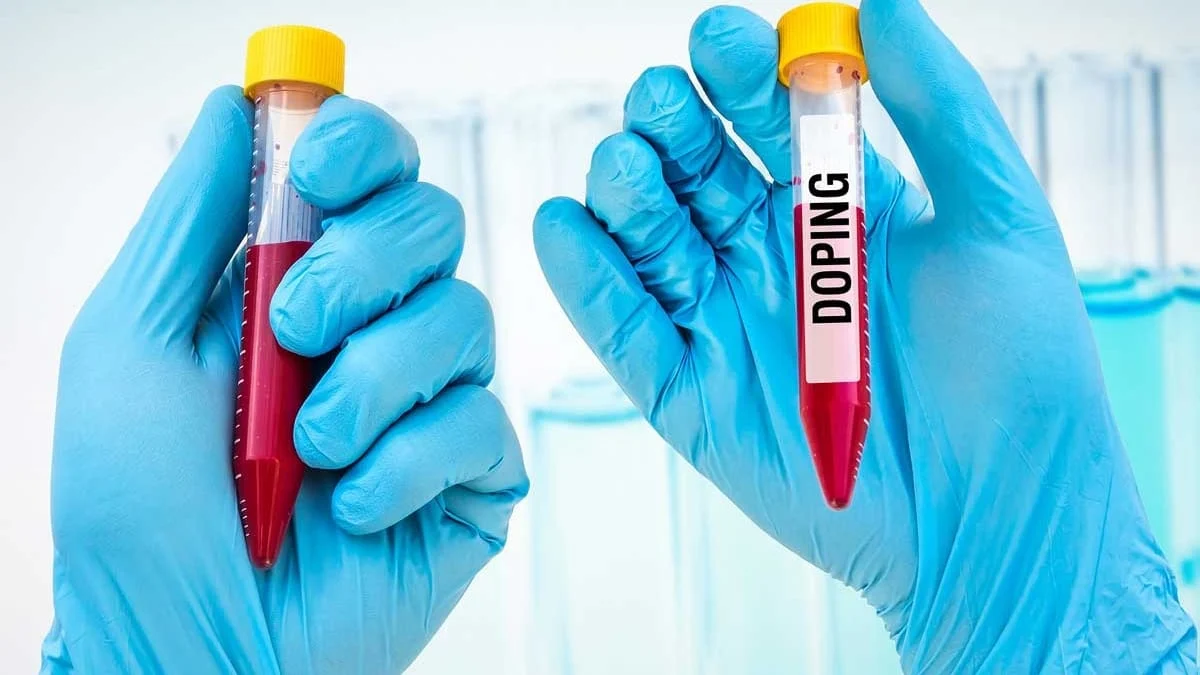What Is Dope Test In Cricket And How It Is Conducted?