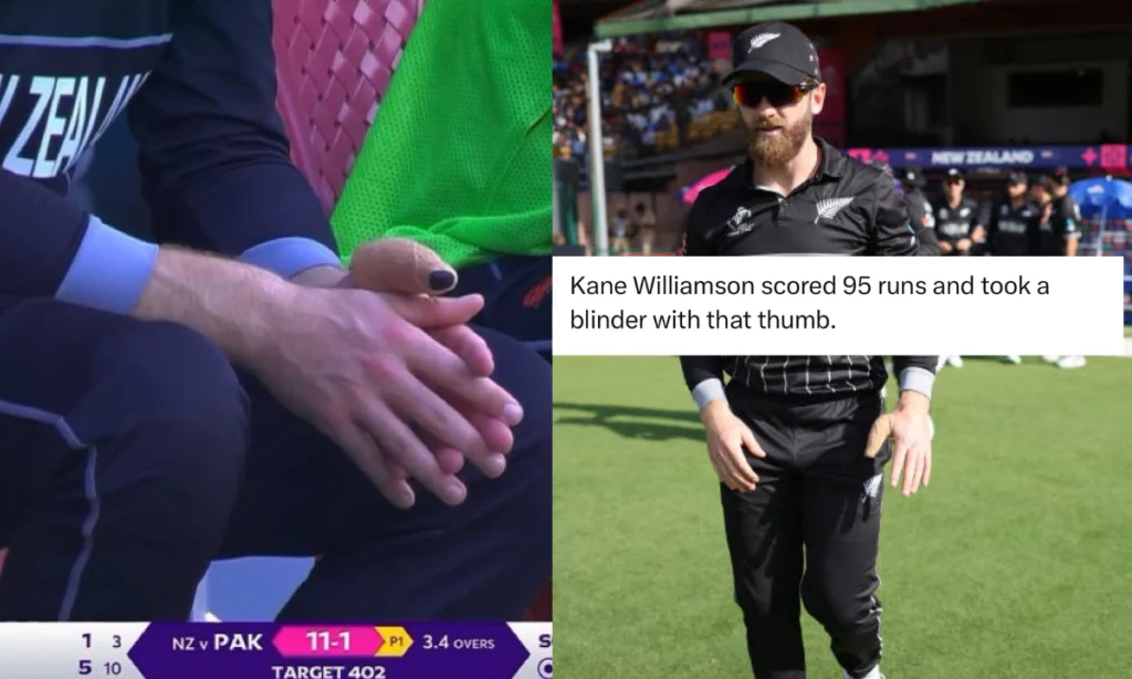 PAK vs NZ: Fans Praise Kane Williamson After Image Of Bandaged Thumb Goes Viral
