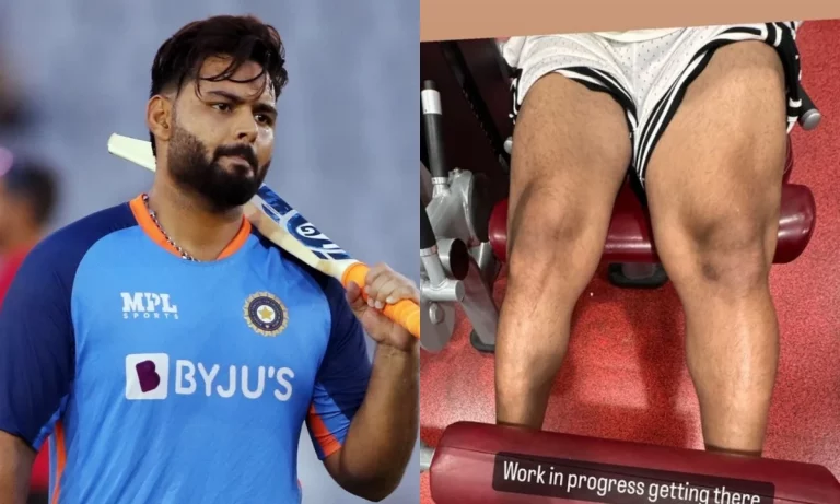 Rishabh Pant Shares Image Of Scars On His Leg One Year After Horrific Car Accident