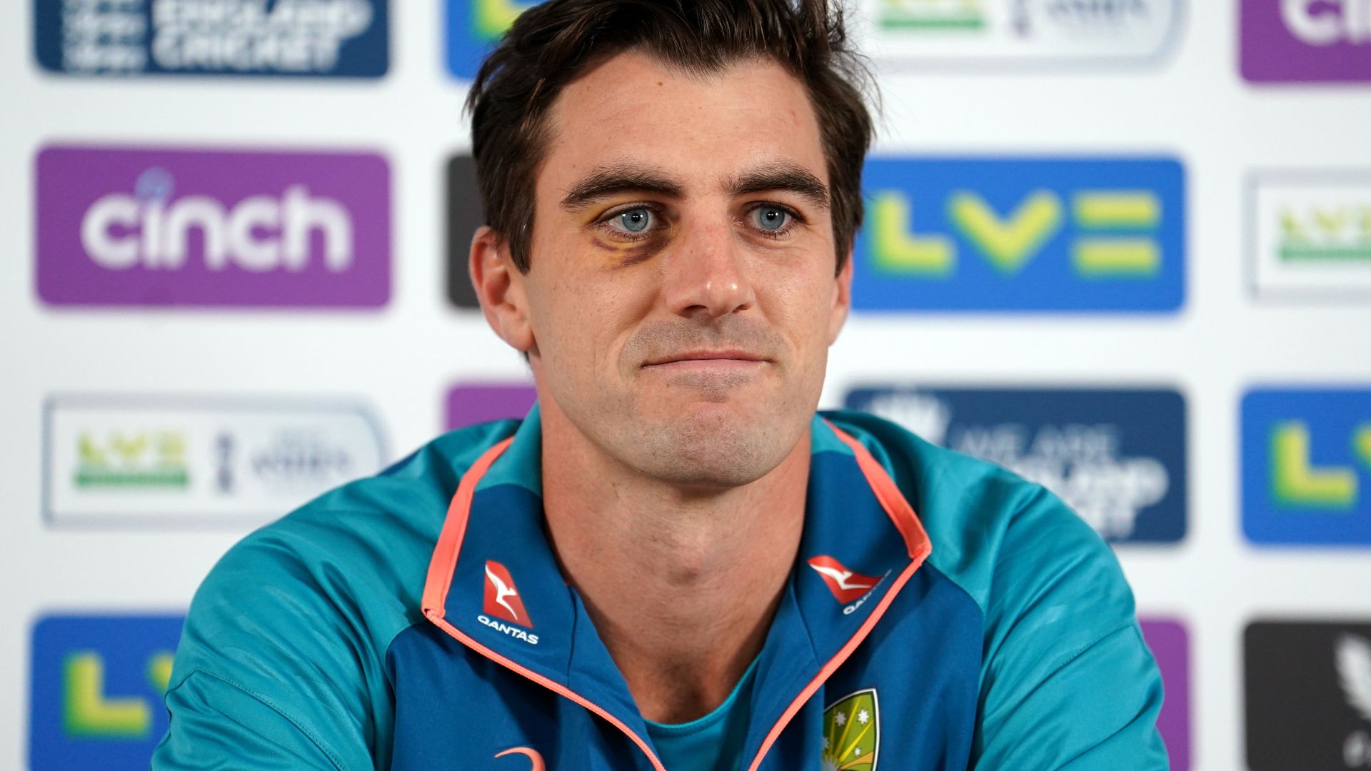 5 Undeniable Reasons Pat Cummins Has Quietly Eclipsed Every Other Modern Legend